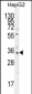 OR52I2 Antibody (C-term)